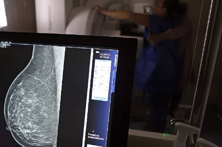 Médicos lançam guia para evitar recusa de mamografia digital