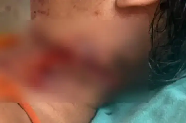 Mulher é socorrida com ferimento no pescoço e Polícia Civil investiga o caso em São Francisco do Guaporé