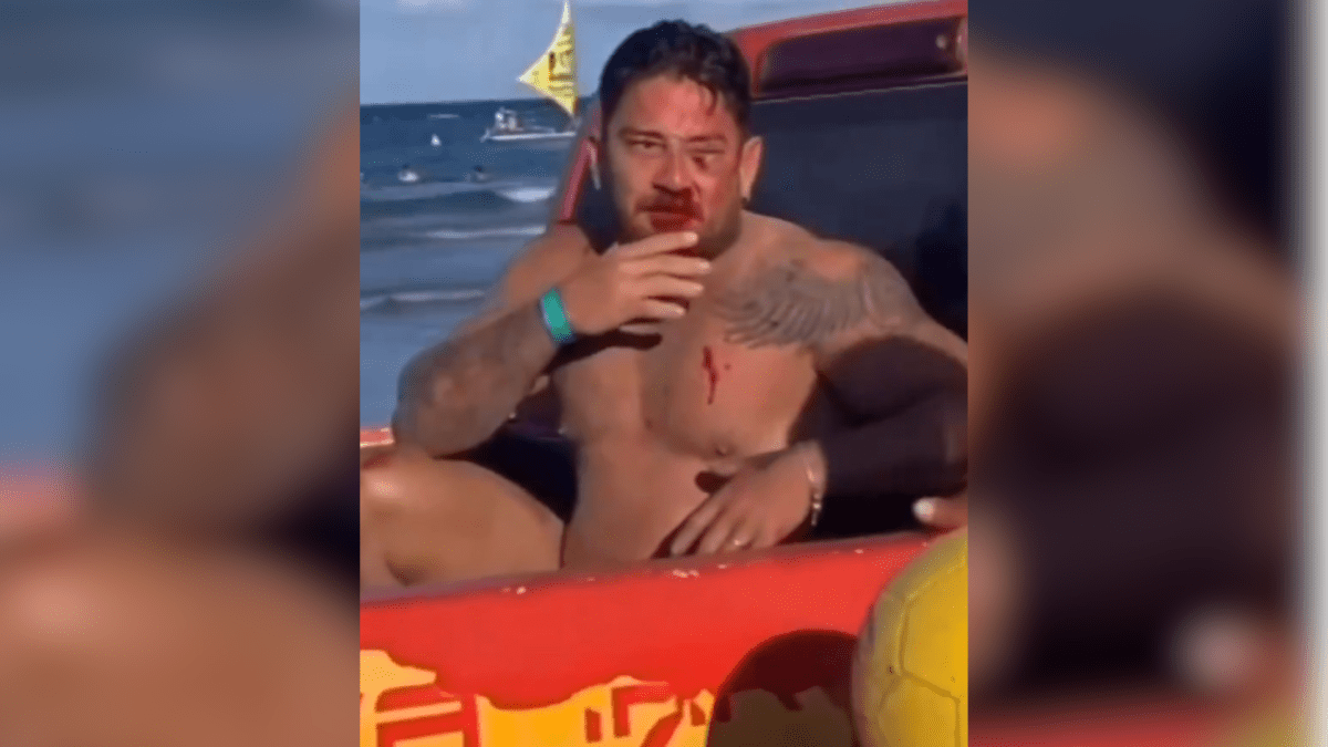“Tinha uns 30 em cima da gente”, diz casal agredido em Porto de Galinhas