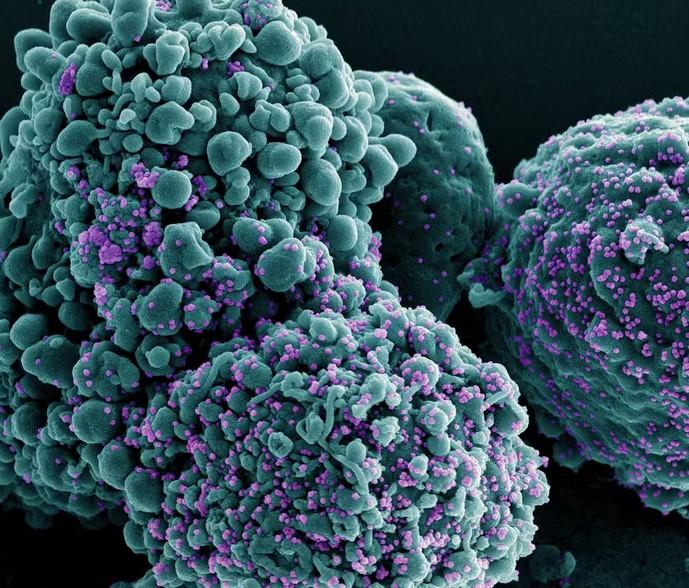 Nova variante da Covid-19 com maior escape imune é detectada em 23 países