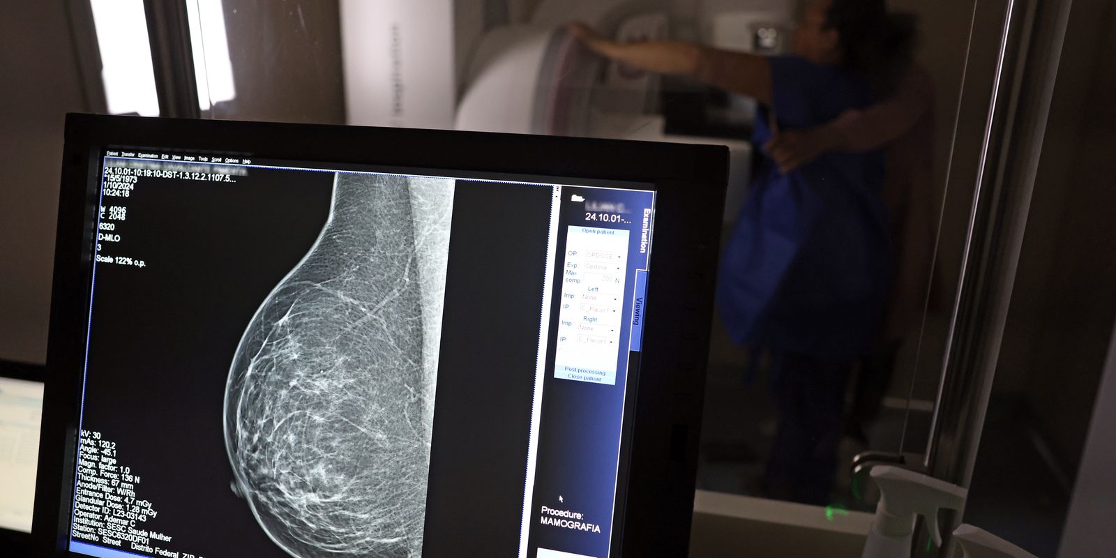 Médicos lançam guia para evitar recusa de mamografia digital